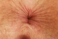 ATK hairy Apricot Pitts Set