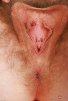 ATK hairy Apricot Pitts Set