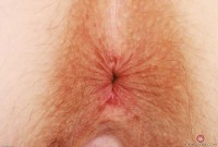 ATK hairy Apricot Pitts in young and hairy