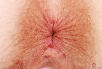 ATK hairy Apricot Pitts Set