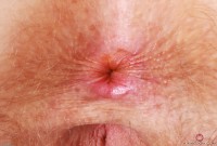 ATK hairy Apricot Pitts Set