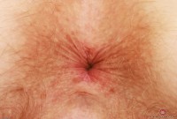 ATK hairy Apricot Pitts Set