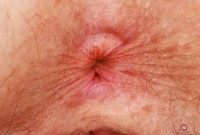 ATK hairy Apricot Pitts in hairy fun