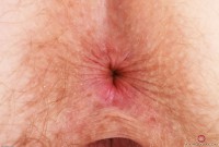 ATK hairy Apricot Pitts in young and hairy