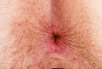 ATK hairy Apricot Pitts Set
