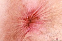 ATK hairy Apricot Pitts Set