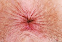 ATK hairy Apricot Pitts in young and hairy
