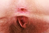 ATK hairy Apricot Pitts in young and hairy