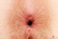 ATK hairy Apricot Pitts in young and hairy