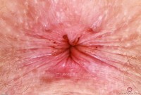 ATK hairy Apricot Pitts Set