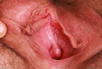 ATK hairy Apricot Pitts in young and hairy
