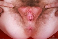 ATK hairy Apricot Pitts in young and hairy