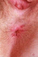 ATK hairy Apricot Pitts in young and hairy