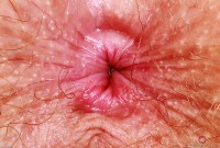 ATK hairy Apricot Pitts in young and hairy