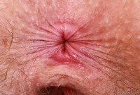 ATK hairy Apricot Pitts Set