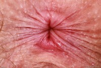 ATK hairy Apricot Pitts in young and hairy
