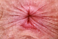 ATK hairy Apricot Pitts Set