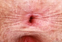ATK hairy Apricot Pitts in young and hairy