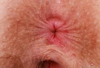 ATK hairy Apricot Pitts Set