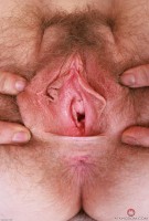 ATK hairy Apricot Pitts Set