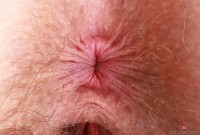 ATK hairy Apricot Pitts in young and hairy
