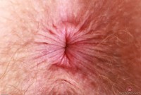 ATK hairy Apricot Pitts in young and hairy