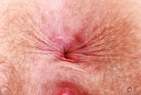 ATK hairy Apricot Pitts Set