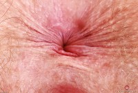 ATK hairy Apricot Pitts Set