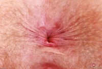 ATK hairy Apricot Pitts Set