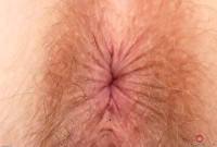ATK hairy Apricot Pitts Set