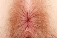 ATK hairy Apricot Pitts Set