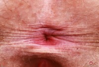 ATK hairy Apricot Pitts in young and hairy