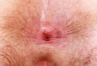 ATK hairy Apricot Pitts Set