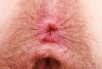 ATK hairy Apricot Pitts Set