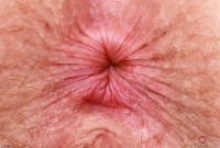 ATK hairy Apricot Pitts Set