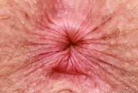 ATK hairy Apricot Pitts Set