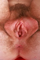 ATK hairy Apricot Pitts Set