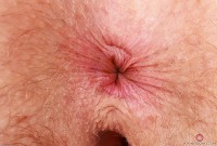 ATK hairy Apricot Pitts Set