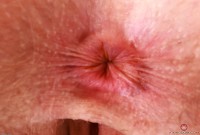 ATK hairy Apricot Pitts Set