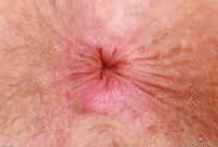 ATK hairy Apricot Pitts in young and hairy