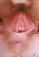 ATK hairy Apricot Pitts Set