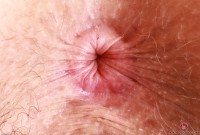 ATK hairy Apricot Pitts Set