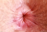 ATK hairy Apricot Pitts Set