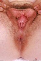 ATK hairy Apricot Pitts Set