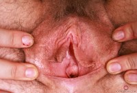 ATK hairy Apricot Pitts Set