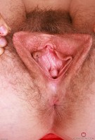 ATK hairy Apricot Pitts Set