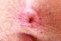 ATK hairy Apricot Pitts Set