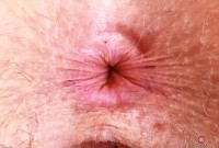 ATK hairy Apricot Pitts Set