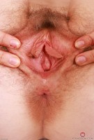 ATK hairy Apricot Pitts Set