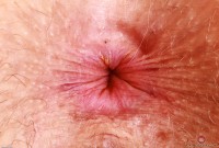 ATK hairy Apricot Pitts Set